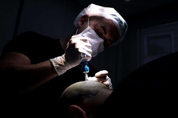 انتخاب بهترین کلینیک کاشت مو توسط انجمن پیوند موی ایران