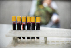 بیش از ۴۴ هزار واحد خون در آذربایجان غربی اهدا شد