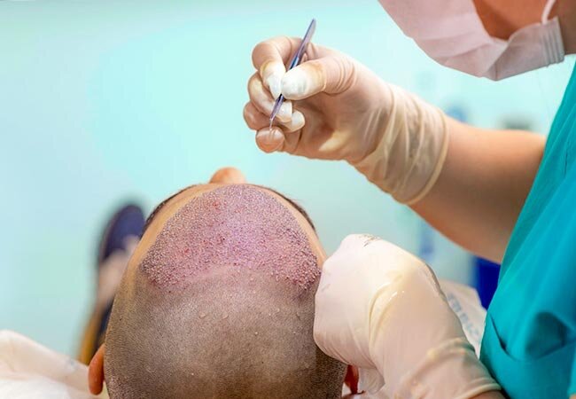 معرفی کلینیک مورد تایید انجمن کاشت موی ایران