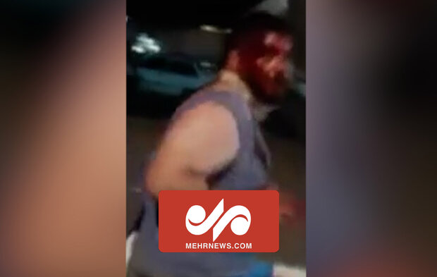 ضرب و شتم نیروی حافظ امنیت با قمه در اغتشاشات پاکدشت