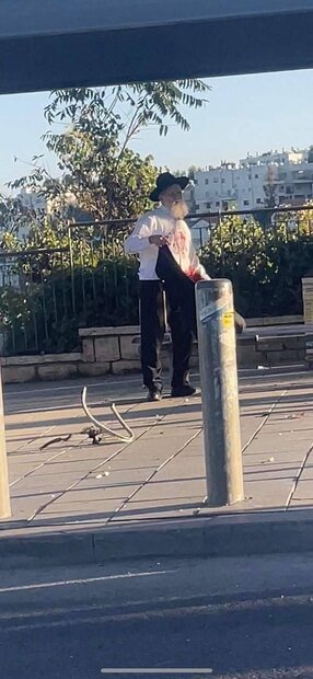 ۲ انفجار شدید در قدس اشغالی/ ۱۲صهیونیست زخمی شدند+ فیلم و تصاویر