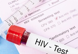 ۴۹۵ مبتلا به ویروس اچ آی وی در آذربایجان شرقی شناسایی شده است