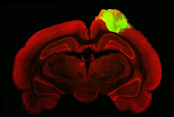ارگانوئید مغز انسان به موش پیوند زده شد
