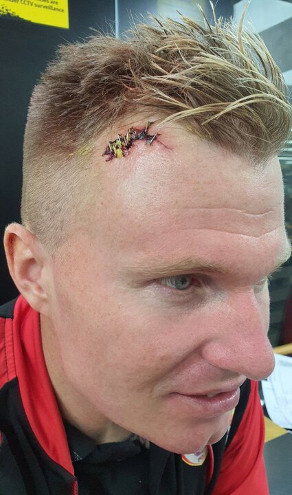 آسیب دیدگی سر دروازهبان فولاد در بازی با الهلال