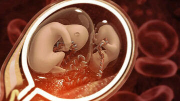 ۲۵ مورد اهدای جنین در مرکز درمان ناباروری سنندج ثبت شد