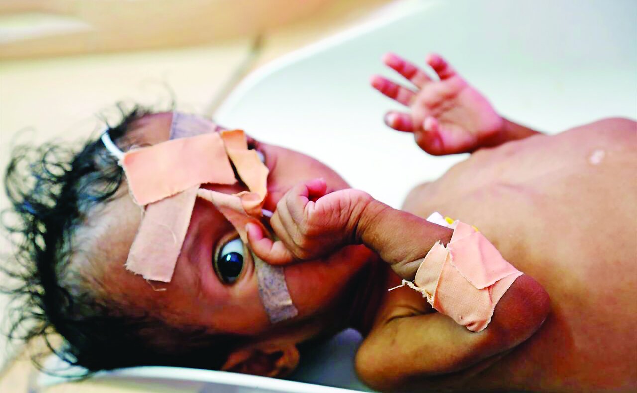 Yemen war