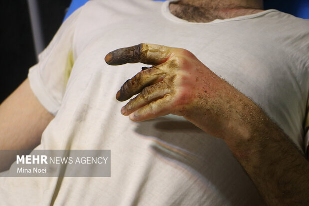 آمار مصدومان چهارشنبهسوری/کدام استانها بیشترین حادثه را داشتند؟