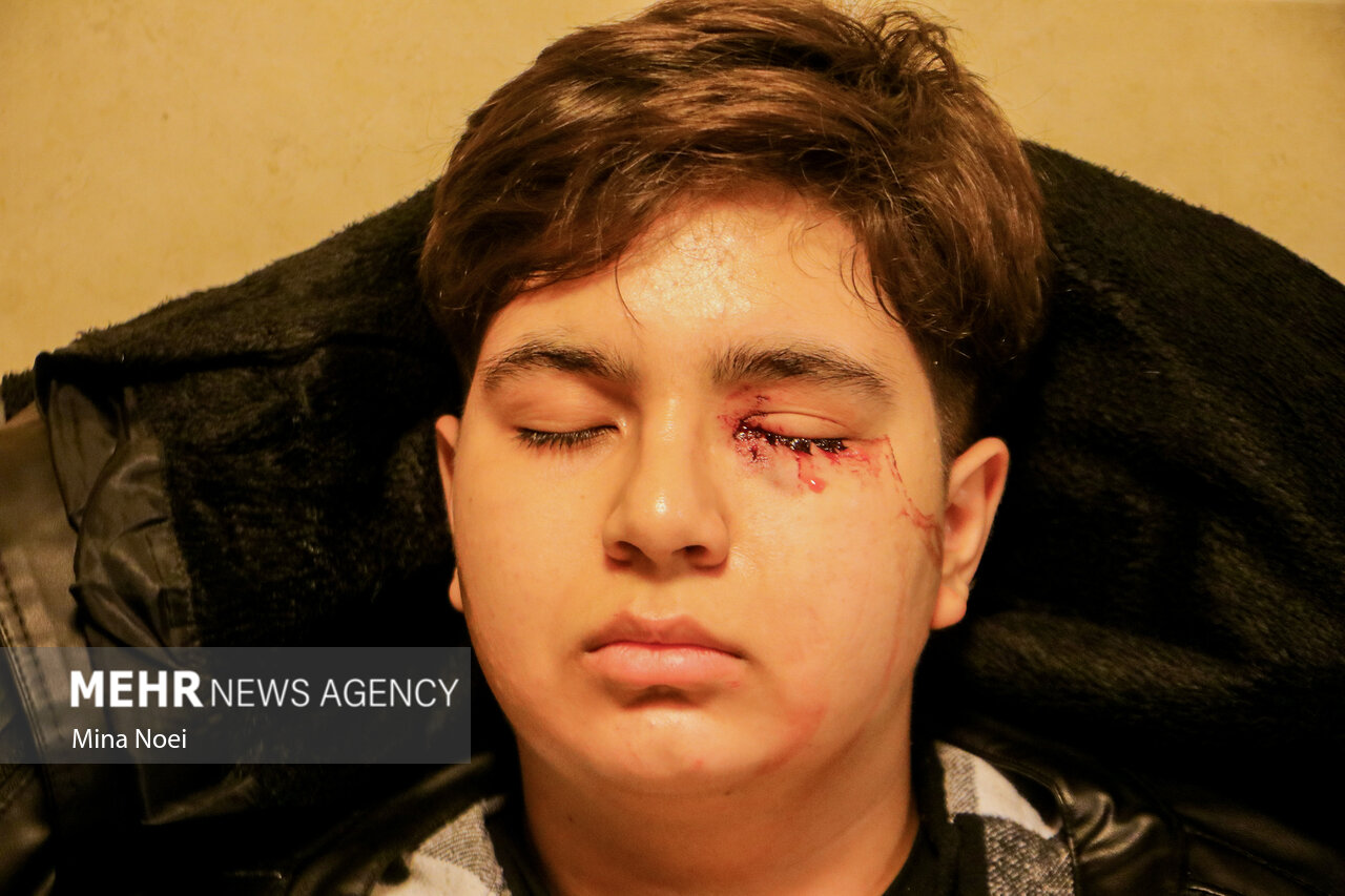 آمار مصدومان چهارشنبهسوری/کدام استانها بیشترین حادثه را داشتند؟