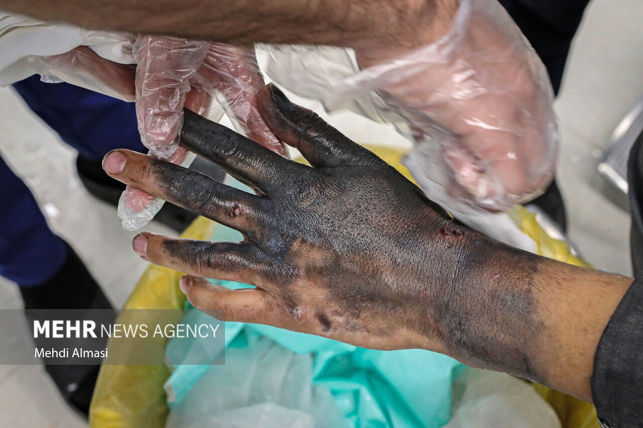 آمار مصدومان چهارشنبهسوری/کدام استانها بیشترین حادثه را داشتند؟