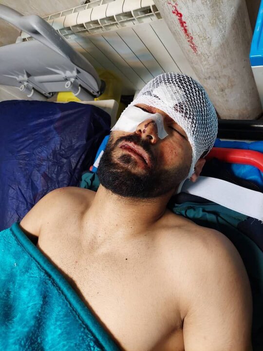 خطر از بیخ گوش مدافع پیکان گذشت