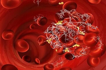 توزیع فرآورده خونی فاکتور ۸/تلاش هلال‌احمر برای رفع نیاز بیماران‌ هموفیلی