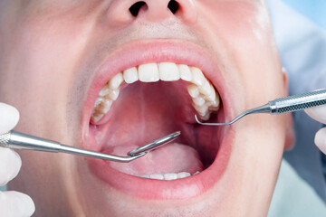 ارائه خدمات رایگان دندان پزشکی به معتادان متجاهر سنندجی