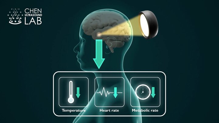 ابداع خواب زمستانی برای انسان ها در سفر فضایی و جراحی