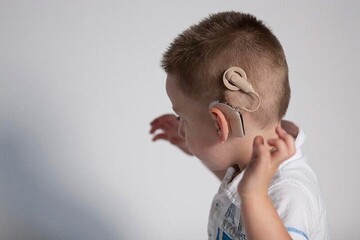 شنوایی‌بخشی به بیش از ۱۰هزار کودک ناشنوا با کمک خیریه‌ بخشش