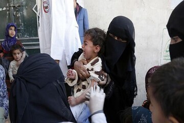 حصبه در یمن جولان می‌دهد/ ۲۵۹ کودک جان دادند