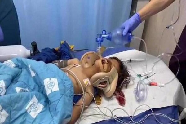 Palestinian child critically injured as Zionist run over him