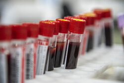 آمادگی سازمان انتقال خون در اجتماع بزرگ اربعین/ استقرار در ۶ گذرگاه مرزی