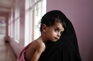 ۱۵۰۰ مادر باردار و شیرده دچار سوء تغذیه در کردستان حمایت می شوند