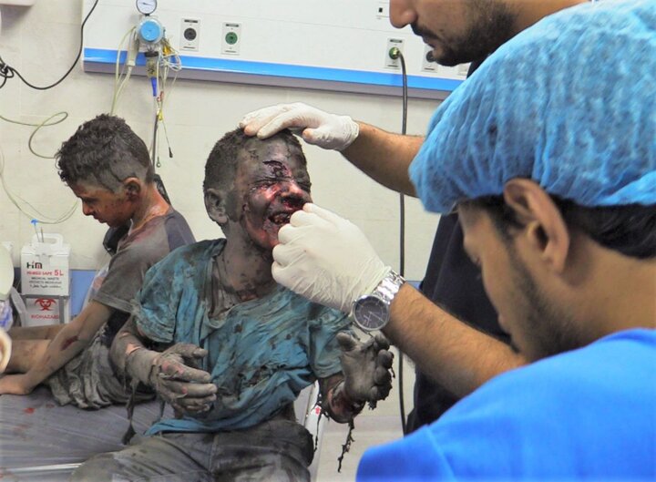 غاصب اسرائیل کی غزہ پر وحشیانہ بمباری جاری، زخمیوں میں 30 سے ​​40 فیصد بچے ہیں