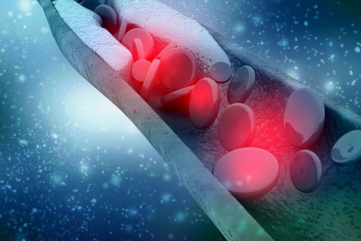 قرص های ضدبارداری خطر لخته شدن خون را افزایش می دهند