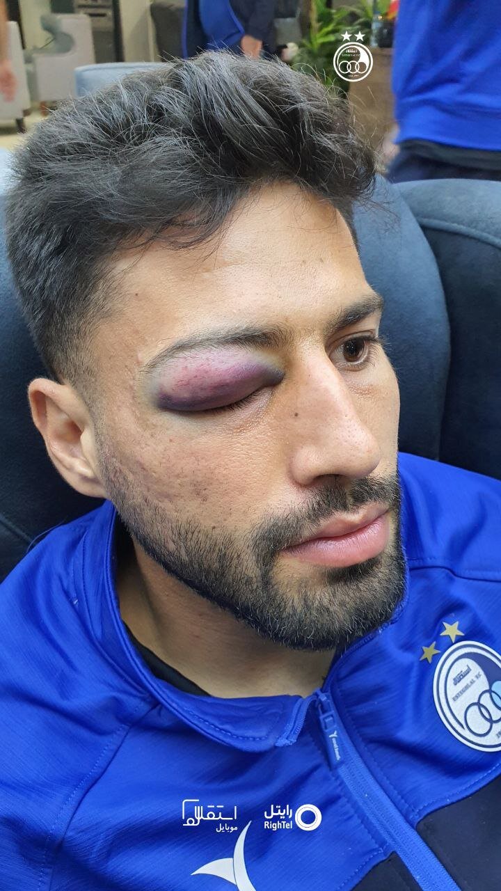 خبر بد برای آبیهای پایتخت/ مدافع استقلال دربی را از دست می دهد؟