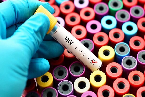 هشدار سازمان جهانی بهداشت نسبت به افزایش موارد ابتلا به HIV در فیلیپین