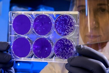 یک نانوذره معدنی شاید جایگزین آنتی بیوتیک‌ها شود