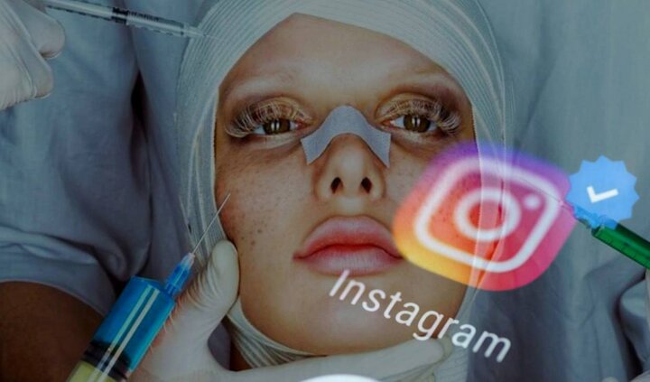 تبانی بلاگرهای اینستاگرامی و جراحان زیبایی تبانی بلاگرهای اینستاگرامی و جراحان زیبایی