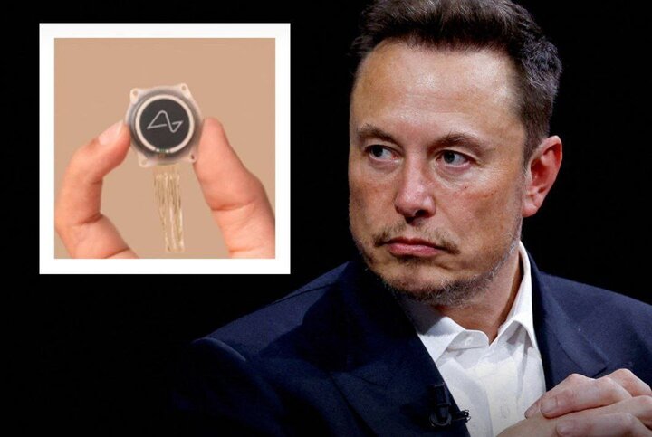 Elon Musk's brain chip implanted in first human