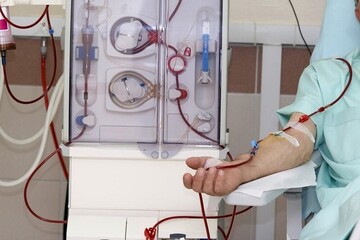 صدور مجوز ترخیص دستگاه‌های دیالیز بیمارستان مردانی آذر از گمرک
