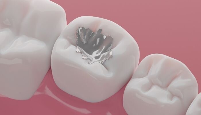 نکات مهم هنگام تهیه مواد دندانپزشکی برای دندانپزشکان 