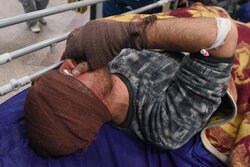 چهارشنبه سوری در کرمانشاه ۲۱۷ مصدوم و ۶ قطع عضو به جا گذاشت