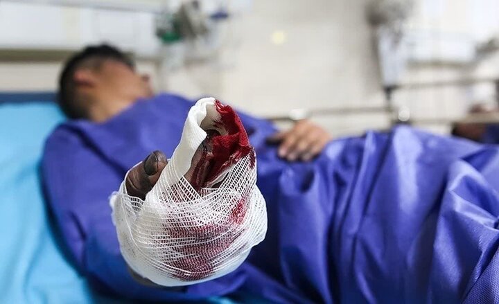 مچ دست یک نفر در حادثه چهارشنبه آخرسال قم قطع شد/حوادث فوتی نداشت مچ دست یک نفر در حادثه چهارشنبه آخرسال قم قطع شد/حوادث فوتی نداشت