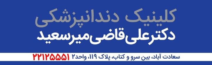 ایمپلنت دندان جایگزینی برای دندان های از دست رفته