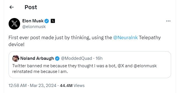 نخستین دریافت کننده تراشه نورالینک پستی در ایکس منتشر کرد