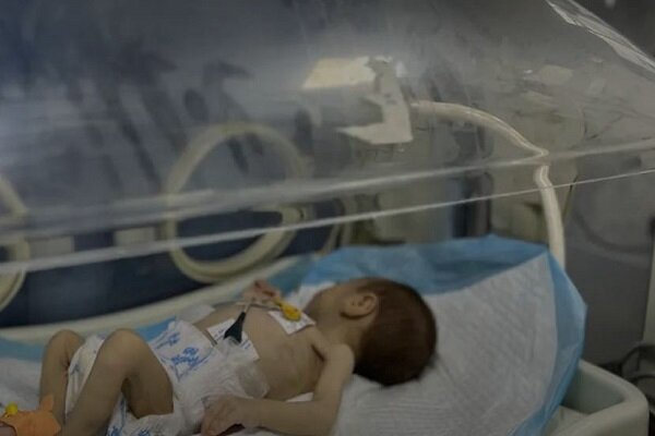 Gazzeli bebeğin ölümle mücadelesi yürekleri dağladı