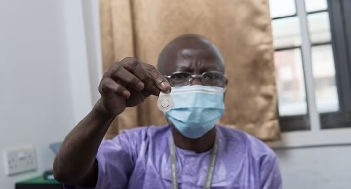 واکسن سرخک و سرخجه بدون درد از راه رسید