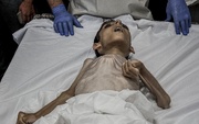 شهادت ۳۰ کودک در نتیجه گرسنگی در غزه 