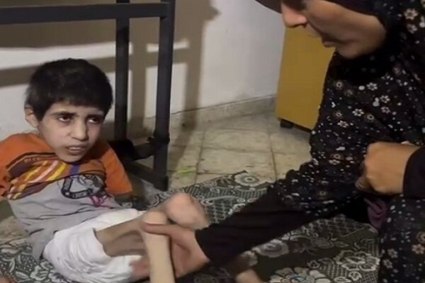 تصاویر تالم‌آور از وضعیت بغرنج کودک فلسطینی در نتیجه گرسنگی شدید