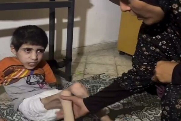 تصاویر تالمآور از وضعیت بغرنج کودک فلسطینی در نتیجه گرسنگی شدید تصاویر تالمآور از وضعیت بغرنج کودک فلسطینی در نتیجه گرسنگی شدید