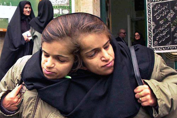 دوقلوهایی که هرگز یکدیگر را در آغوش نگرفتند