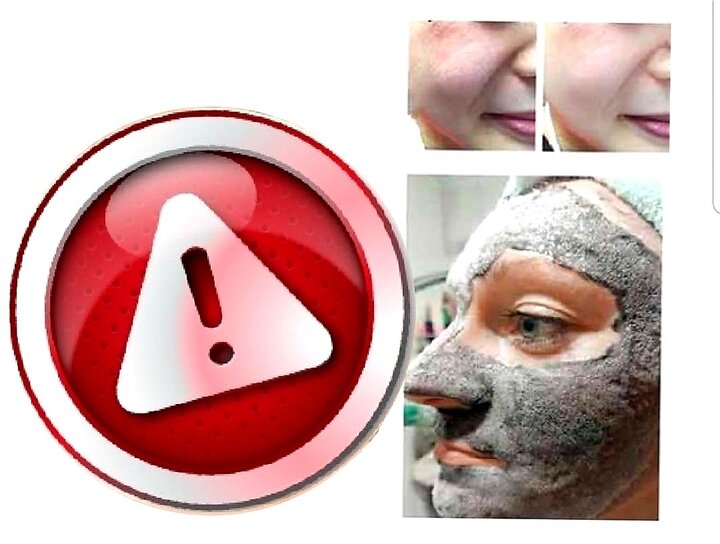 عوارض ماندگار ماسکهای خانگی عوارض ماندگار ماسکهای خانگی