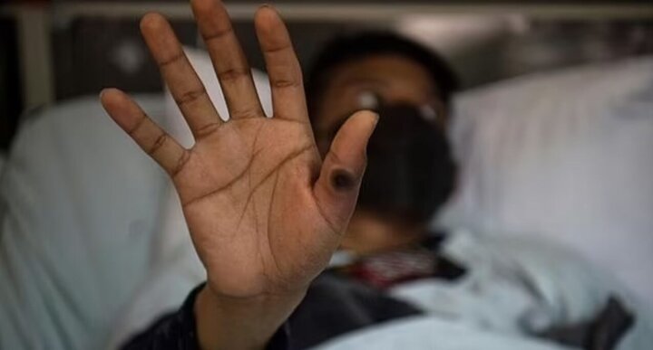 Dünya Sağlık Örgütü, maymun çiçeği virüsüne karşı ilk aşıya onay verdi Dünya Sağlık Örgütü, maymun çiçeği virüsüne karşı ilk aşıya onay verdi