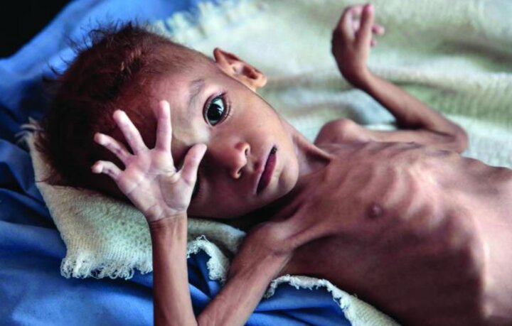 Nearly 480,000 children suffering from malnutrition in Kenya