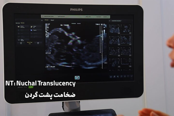 دغدغه‌مندشدن افراد بی‌تفاوت با«لابیرنت»/«حیات جنین» را جدی بگیریم