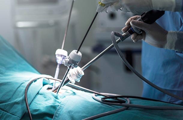 بومیسازی تروکار لاپاراسکوپی توسط فناوران دانشگاه شریف