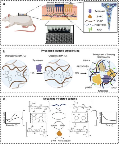 وصله ریز سوزن محققان ایرانی از بیماران دیابتی مراقبت میکند