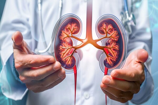 راهبردهای موثر در جلوگیری از بیماریهای مزمن کلیه – خبرگزاری مهر | اخبار داخلی و خارجی راهبردهای موثر در جلوگیری از بیماریهای مزمن کلیه – خبرگزاری مهر | اخبار داخلی و خارجی