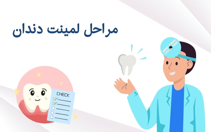 لمینت دندان چگونه انجام میشود و مناسب چه کسانی است؟
