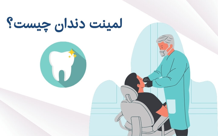 لمینت دندان چگونه انجام میشود و مناسب چه کسانی است؟